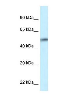 CAMK2D / CaMKII Delta Antibody - CAMK2D antibody Western blot of HT1080 Cell lysate. Antibody concentration 1 ug/ml.  This image was taken for the unconjugated form of this product. Other forms have not been tested.