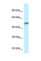 CAMK2D / CaMKII Delta Antibody - CAMK2D antibody Western blot of HT1080 Cell lysate. Antibody concentration 1 ug/ml.  This image was taken for the unconjugated form of this product. Other forms have not been tested.