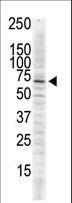 CAMK2D / CaMKII Delta Antibody - The anti-CAMK2delta C-term antibody is used in Western blot to detect CAMK2 delta in serum-starved HeLa cell lysate.