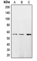 CAMK2D / CaMKII Delta Antibody - Western blot analysis of CaMK2 delta expression in HeLa (A); A431 (B); H1299 (C) whole cell lysates.