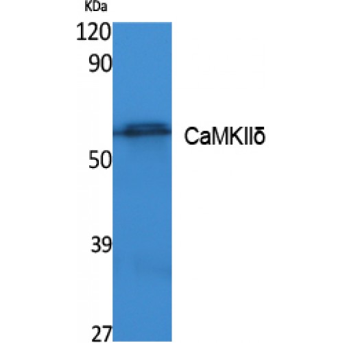 CAMK2D / CaMKII Delta Antibody - Western blot of CaMKII delta antibody