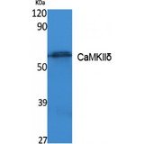 CAMK2D / CaMKII Delta Antibody - Western blot of CaMKII delta antibody