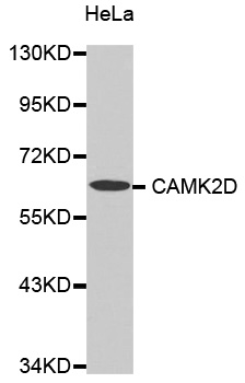 CAMK2D / CaMKII Delta Antibody - Western blot analysis of extracts of HeLa cells tissue.