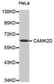 CAMK2D / CaMKII Delta Antibody - Western blot analysis of extracts of HeLa cells tissue.