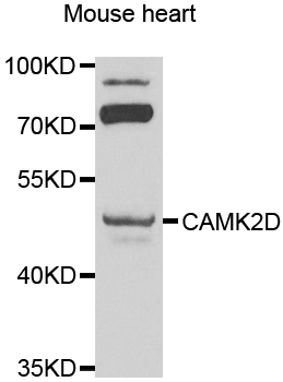 CAMK2D / CaMKII Delta Antibody - Western blot analysis of extracts of mouse heart, using CAMK2D antibody at 1:1000 dilution. The secondary antibody used was an HRP Goat Anti-Rabbit IgG (H+L) at 1:10000 dilution. Lysates were loaded 25ug per lane and 3% nonfat dry milk in TBST was used for blocking. An ECL Kit was used for detection and the exposure time was 90s.