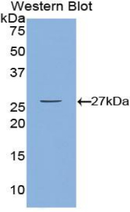 CAMK2G / CaMK II Gamma Antibody - Western blot of recombinant CAMK2G / CAMK.  This image was taken for the unconjugated form of this product. Other forms have not been tested.