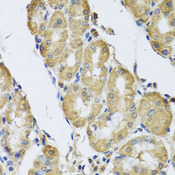 CAMK2G / CaMK II Gamma Antibody - Immunohistochemistry of paraffin-embedded human stomach tissue.
