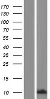 CAMK2N2 / CAMKIIN Protein - Western validation with an anti-DDK antibody * L: Control HEK293 lysate R: Over-expression lysate