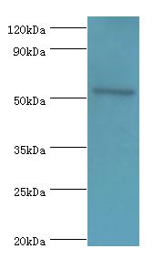 CAMK4 / CaMK IV Antibody - Western blot. All lanes: CAMK4 antibody at 2 ug/ml+293T whole cell lysate. Secondary antibody: Goat polyclonal to rabbit at 1:10000 dilution. Predicted band size: 52 kDa. Observed band size: 52 kDa.