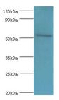 CAMK4 / CaMK IV Antibody - Western blot. All lanes: CAMK4 antibody at 2 ug/ml+293T whole cell lysate. Secondary antibody: Goat polyclonal to rabbit at 1:10000 dilution. Predicted band size: 52 kDa. Observed band size: 52 kDa.