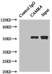 CAMK4 / CaMK IV Antibody - Immunoprecipitating CAMK4 in Jurkat whole cell lysate Lane 1: Rabbit monoclonal IgG (1µg) instead of CAMK4 Antibody in Jurkat whole cell lysate.For western blotting, a HRP-conjugated anti-rabbit IgG, specific to the non-reduced form of IgG was used as the Secondary antibody (1/50000) Lane 2: CAMK4 Antibody (4µg) + Jurkat whole cell lysate (500µg) Lane 3: Jurkat whole cell lysate (20µg)
