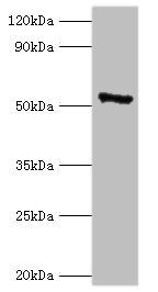 CAMK4 / CaMK IV Antibody - Western blot All lanes: CAMK4 antibody at 2µg/ml + 293T whole cell lysate Secondary Goat polyclonal to rabbit IgG at 1/10000 dilution Predicted band size: 52 kDa Observed band size: 52 kDa