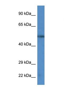 CAMK4 / CaMK IV Antibody - CAMK4 antibody Western blot of HepG2 Cell lysate. Antibody concentration 1 ug/ml.  This image was taken for the unconjugated form of this product. Other forms have not been tested.