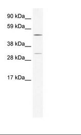 CAMK4 / CaMK IV Antibody - Thymus Lysate.  This image was taken for the unconjugated form of this product. Other forms have not been tested.
