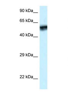 CAMK4 / CaMK IV Antibody - CAMK4 antibody Western blot of ACHN Cell lysate. Antibody concentration 1 ug/ml.  This image was taken for the unconjugated form of this product. Other forms have not been tested.