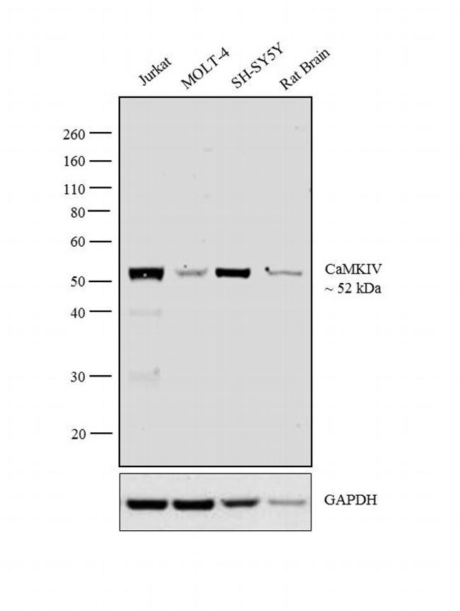 CAMK4 / CaMK IV Antibody - CaMKIV Antibody in Western Blot (WB)
