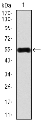 CAMK4 / CaMK IV Antibody - Western blot using CAMK4 monoclonal antibody against human CAMK4 recombinant protein. (Expected MW is 54.8 kDa)