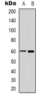 CAMK4 / CaMK IV Antibody - Western blot analysis of CaMK4 expression in Jurkat (A); K562 (B) whole cell lysates.