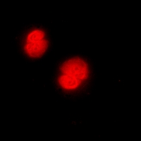 CAMK4 / CaMK IV Antibody - Immunofluorescent analysis of CaMK4 staining in Jurkat cells. Formalin-fixed cells were permeabilized with 0.1% Triton X-100 in TBS for 5-10 minutes and blocked with 3% BSA-PBS for 30 minutes at room temperature. Cells were probed with the primary antibody in 3% BSA-PBS and incubated overnight at 4 deg C in a humidified chamber. Cells were washed with PBST and incubated with a DyLight 594-conjugated secondary antibody (red) in PBS at room temperature in the dark. DAPI was used to stain the cell nuclei (blue).