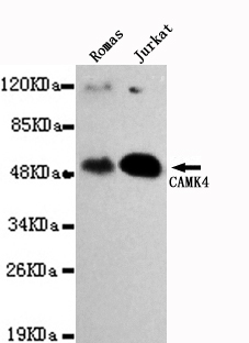 CAMK4 / CaMK IV Antibody - Western blot detection of CAMK4 in Romas&Jurkat cell lysates using CAMK4 antibody (1:1000 diluted).