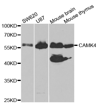 CAMK4 / CaMK IV Antibody - Western blot analysis of extracts of various cell lines.