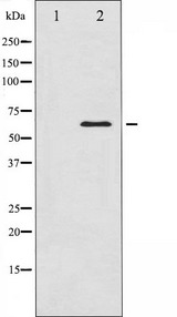 CAMK4 / CaMK IV Antibody - Western blot analysis of CaMK4 expression in H2O2 treated K562 whole cells lysates. The lane on the left is treated with the antigen-specific peptide.
