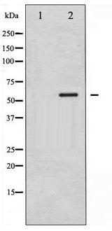 CAMK4 / CaMK IV Antibody - Western blot of CaMK4 phosphorylation expression in H2O2 treated K562 whole cell lysates,The lane on the left is treated with the antigen-specific peptide.