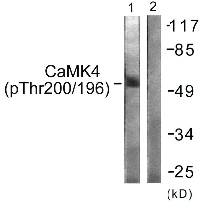 CAMK4 / CaMK IV Antibody - Western blot analysis of extracts from K562 cells, treated with H2O2 (100uM, 30mins), using CaMK4 (Phospho-Thr196/200) antibody.