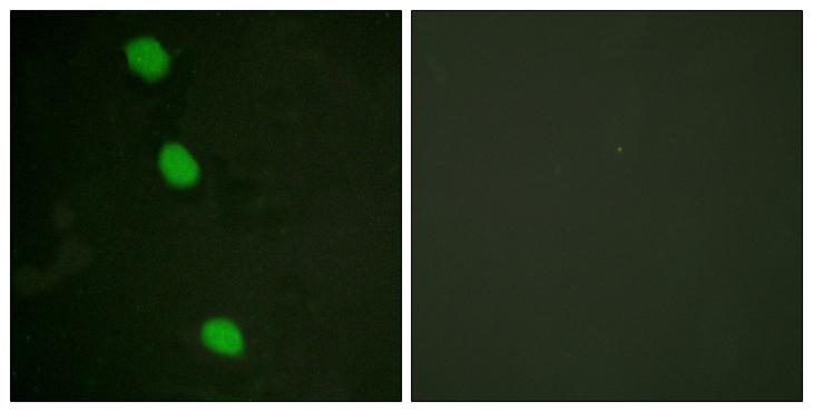 CAMK4 / CaMK IV Antibody - P-peptide - + Immunofluorescence analysis of HeLa cells, using CaMK4 (Phospho-Thr196/200) antibody.