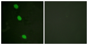 CAMK4 / CaMK IV Antibody - Immunofluorescence of HeLa cells, using CaMK4 (Phospho-Thr196/200) Antibody. The sample on the right was incubated with synthetic peptide.