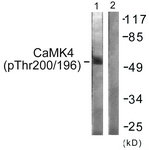 CAMK4 / CaMK IV Antibody - Western blot of extracts from K562 cells treated with H2O2 100uM 30', using CaMK4 (Phospho-Thr196/200) Antibody. The lane on the right was incubated with synthetic peptide.