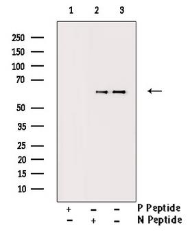 CAMK4 / CaMK IV Antibody - Western blot analysis of Phospho-CaMK4 (Thr196/200) antibody expression in H2O2 treated K562 cells lysates. The lane on the right is treated with the antigen-specific peptide.
