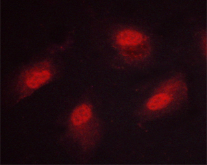 CAMK4 / CaMK IV Antibody - Staining HeLa cells by IF/ICC. The samples were fixed with PFA and permeabilized in 0.1% saponin prior to blocking in 10% serum for 45 min at 37°C. The primary antibody was diluted 1/400 and incubated with the sample for 1 hour at 37°C. A Alexa Fluor 594 conjugated goat polyclonal to rabbit IgG (H+L), diluted 1/600 was used as secondary antibody.