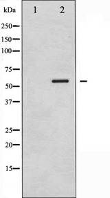 CAMK4 / CaMK IV Antibody - Western blot analysis of CaMK4 phosphorylation expression in H2O2 treated K562 whole cells lysates. The lane on the left is treated with the antigen-specific peptide.
