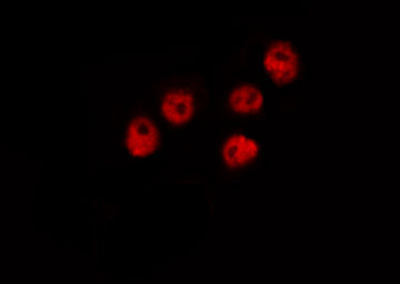 CAMK4 / CaMK IV Antibody - Staining K562 cells by IF/ICC. The samples were fixed with PFA and permeabilized in 0.1% Triton X-100, then blocked in 10% serum for 45 min at 25°C. The primary antibody was diluted at 1:200 and incubated with the sample for 1 hour at 37°C. An Alexa Fluor 594 conjugated goat anti-rabbit IgG (H+L) Ab, diluted at 1/600, was used as the secondary antibody.