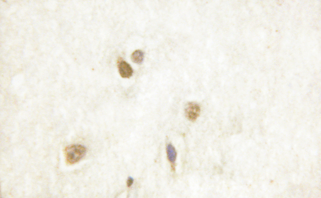 CAMK4 / CaMK IV Antibody - 1/100 staining human brain tissue by IHC-P. The sample was formaldehyde fixed and a heat mediated antigen retrieval step in citrate buffer was performed. The sample was then blocked and incubated with the antibody for 1.5 hours at 22°C. An HRP conjugated goat anti-rabbit antibody was used as the secondary antibody.