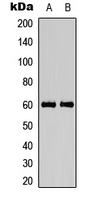 CAMK4 / CaMK IV Antibody - Western blot analysis of CaMK4 (pT200) expression in Jurkat (A); Raji (B) whole cell lysates.