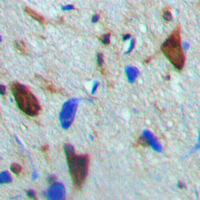 CAMK4 / CaMK IV Antibody - Immunohistochemical analysis of CaMK4 (pT200) staining in human brain formalin fixed paraffin embedded tissue section. The section was pre-treated using heat mediated antigen retrieval with sodium citrate buffer (pH 6.0). The section was then incubated with the antibody at room temperature and detected using an HRP conjugated compact polymer system. DAB was used as the chromogen. The section was then counterstained with hematoxylin and mounted with DPX.