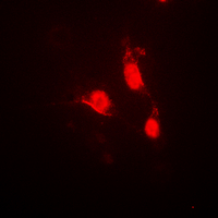 CAMK4 / CaMK IV Antibody - Immunofluorescent analysis of CaMK4 (pT200) staining in Jurkat cells. Formalin-fixed cells were permeabilized with 0.1% Triton X-100 in TBS for 5-10 minutes and blocked with 3% BSA-PBS for 30 minutes at room temperature. Cells were probed with the primary antibody in 3% BSA-PBS and incubated overnight at 4 ??C in a humidified chamber. Cells were washed with PBST and incubated with a DyLight 594-conjugated secondary antibody (red) in PBS at room temperature in the dark. DAPI was used to stain the cell nuclei (blue).