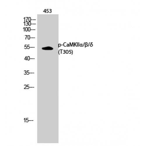 CaMKII Alpha+Beta+Delta Antibody - Western blot of Phospho-CaMKII alpha/beta/delta (T305) antibody