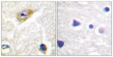 CaMKII Alpha+Beta+Delta Antibody - P-peptide - + Immunohistochemical analysis of paraffin-embedded human brain tissue using CaMKII (Phospho-Thr305) Antibody.