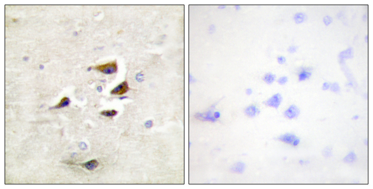CaMKII Alpha+Beta+Delta Antibody - Immunohistochemistry analysis of paraffin-embedded human brain tissue, using CaMK2 alpha/beta/delta Antibody. The picture on the right is blocked with the synthesized peptide.
