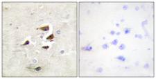 CaMKII Alpha+Beta+Delta Antibody - Immunohistochemistry analysis of paraffin-embedded human brain tissue, using CaMK2 alpha/beta/delta Antibody. The picture on the right is blocked with the synthesized peptide.
