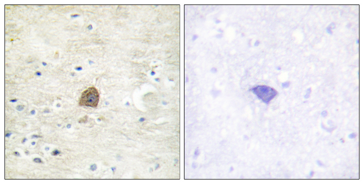 CaMKII Alpha+Beta+Delta Antibody - Immunohistochemistry analysis of paraffin-embedded human brain, using CaMK2 alpha/beta/delta (Phospho-Thr305) Antibody. The picture on the right is blocked with the phospho peptide.
