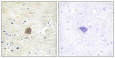 CaMKII Alpha+Beta+Delta Antibody - Immunohistochemistry analysis of paraffin-embedded human brain, using CaMK2 alpha/beta/delta (Phospho-Thr305) Antibody. The picture on the right is blocked with the phospho peptide.