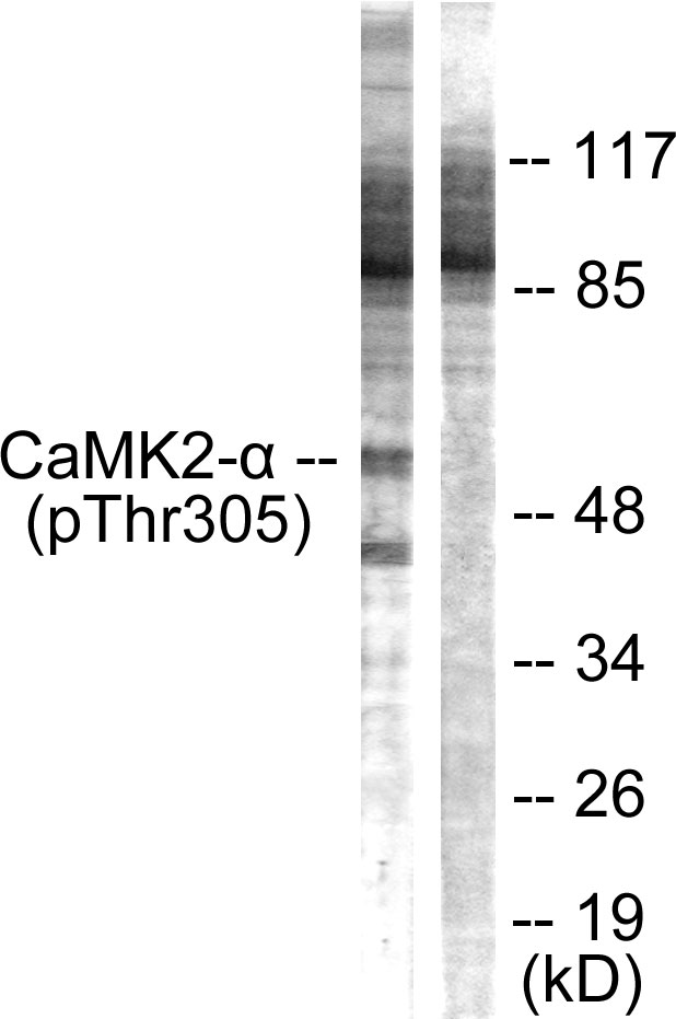 CaMKII Alpha+Beta+Delta Antibody - Western blot analysis of lysates from NIH/3T3 cells, using CaMK2 alpha/beta/delta (Phospho-Thr305) Antibody. The lane on the right is blocked with the phospho peptide.