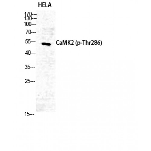 CaMKII Alpha+Delta Antibody - Western blot of Phospho-CaMKII alpha/delta (T286) antibody