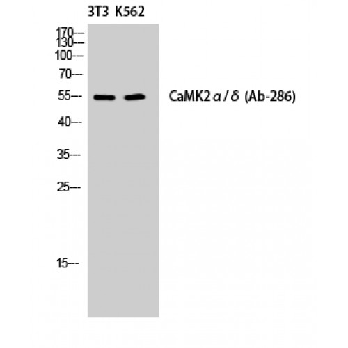 CaMKII Alpha+Delta Antibody - Western blot of CaMKII alpha/delta antibody