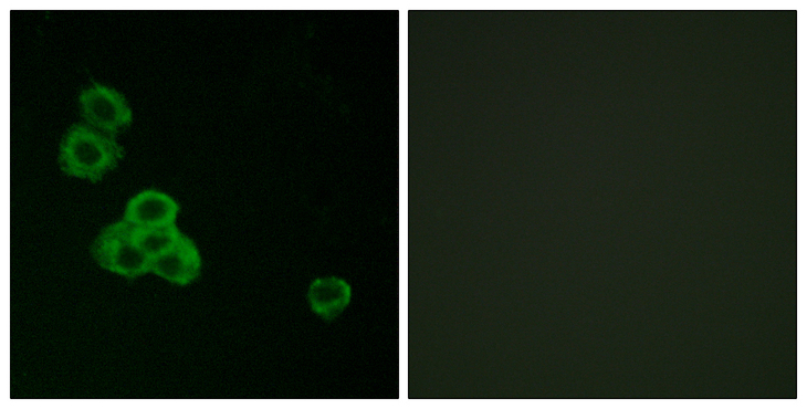 CaMKII Alpha+Delta Antibody - Immunofluorescence analysis of MCF7 cells, using CaMK2 alpha/delta Antibody. The picture on the right is blocked with the synthesized peptide.