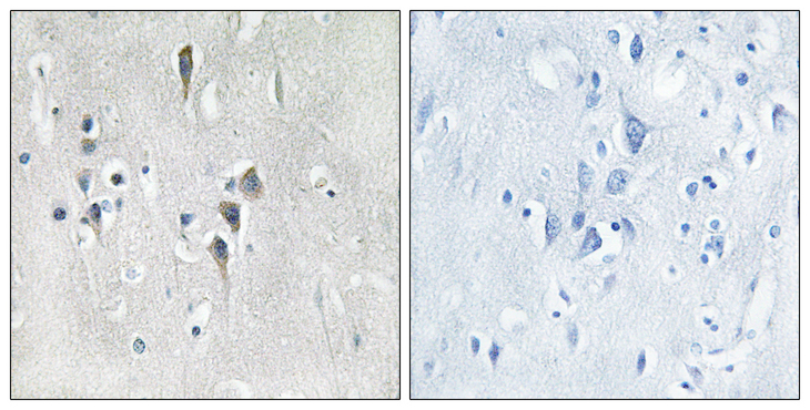 CaMKII Alpha+Delta Antibody - Immunohistochemistry analysis of paraffin-embedded human brain tissue, using CaMK2 alpha/delta Antibody. The picture on the right is blocked with the synthesized peptide.